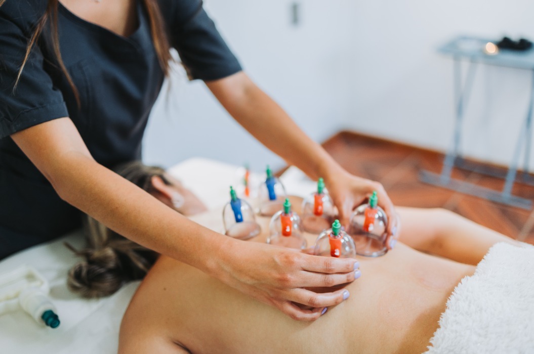 Suction cups placed on a female patient's back, by a massage therapist. Medical spa massage center.